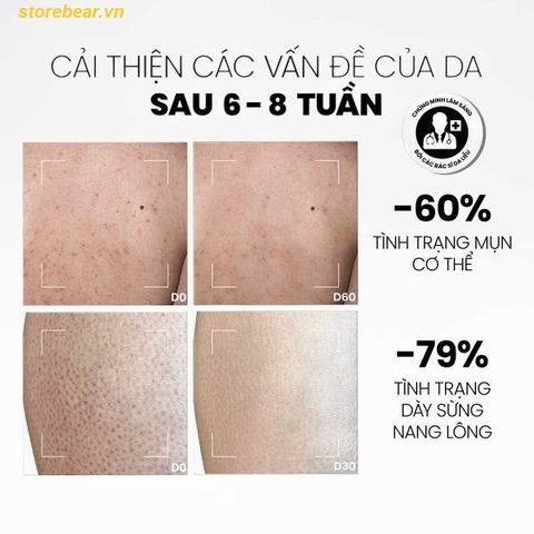 Sữa dưỡng thể MD CARE Calming & Moisturizing Acne Body Lotion 200ml