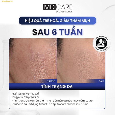 Kem dưỡng sáng da và cải thiện nếp nhăn PRO-Retinol 1.0 30ml