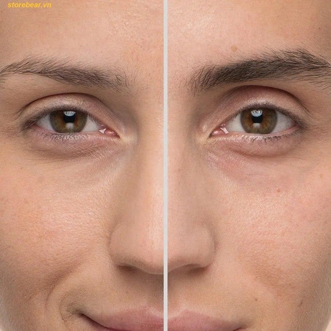 Tinh Chất Hỗ Trợ Làm Dày Lông Mày Obagi Eyebrow Boosting 5ml