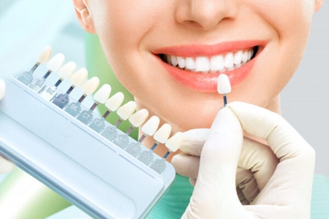 Bật mí 05 lý do nên bọc răng sứ thẩm mỹ bạn nhất định phải biết