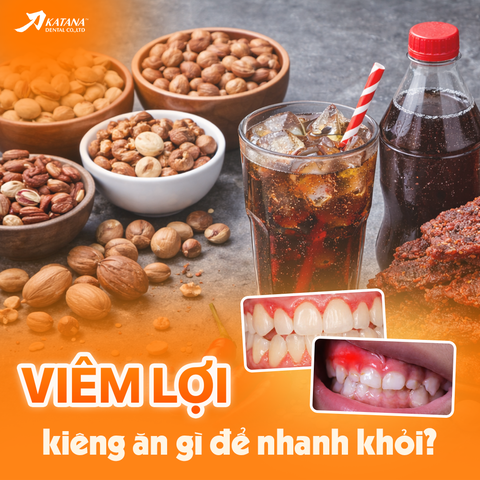 Viêm lợi kiêng ăn gì nhanh khỏi? Top 5+ thực phẩm nên tránh