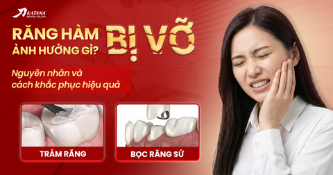 Răng hàm bị vỡ ảnh hưởng gì? Nguyên nhân & cách khắc phục