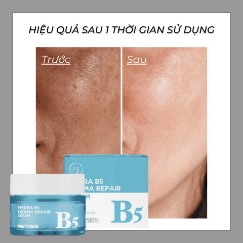 Kem dưỡng B5 Prettyskin Hydra B5 Derma Repair Cream dưỡng ẩm da mặt phục hồi da Hàn Quốc Chính hãng 52ml