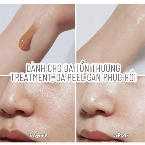 Kem Dưỡng Ẩm Chiết Xuất Rau Má Skin1004 Madagascar Centella 75ml cho da dầu mụn và nhạy cảm Chính hãng Hàn Quốc