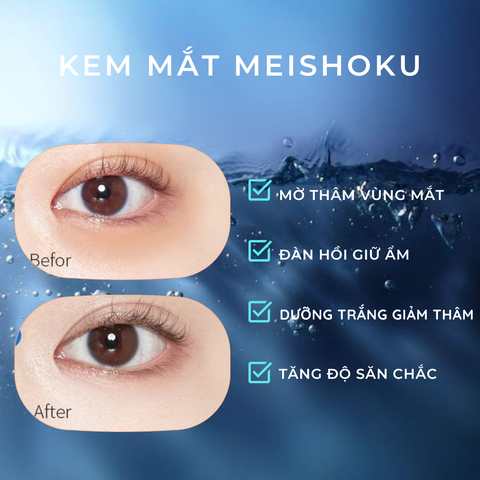 Kem mắt giảm thâm Meishoku Whitening Eye Cream dưỡng mắt giảm quầng thâm chống lão hóa tan bọng Nhật Bản