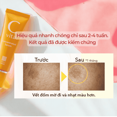 Vitamin C Serum và Lotion Meishoku C Vita dưỡng trắng da dưỡng ẩm tự nhiên từ cam Yuzu Nhật Bản