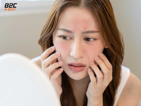 Da Nhạy Cảm Dùng Mỹ Phẩm Gì? Bí Quyết Chọn Mỹ Phẩm An Toàn Và Hiệu Quả