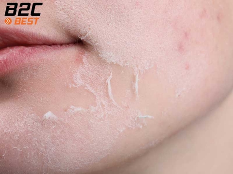 Tái Tạo Da Mặt Là Gì Và Phương Pháp An Toàn Nhất Để Da Luôn Tươi Trẻ