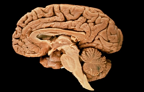 Human Brain 6