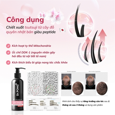 Dầu gội giảm rụng tóc, hỗ trợ mọc tóc Dr.PONG Tsutsuji Gentle 200ml