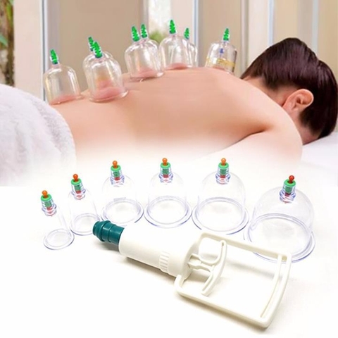 Bộ giác hơi 12 ly không dùng lửa hộp vàng xịn loại 1 [BH: NONE]