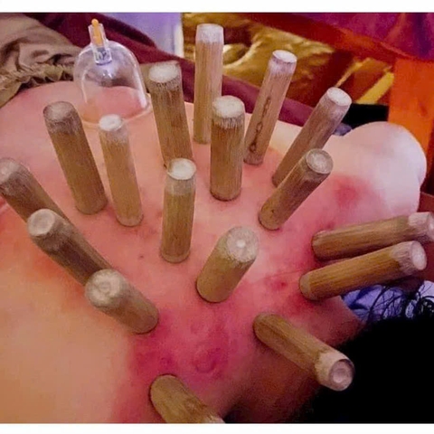 Bộ 10 Ông Tre Nặn Mụn Lăn Ống Tre, Bộ Ống giác hơi tre trúc