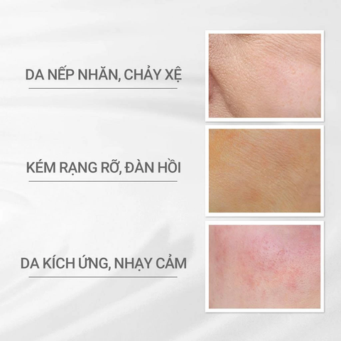 Kem dưỡng chuyên sâu ngăn ngừa lão hoá 45g