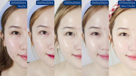 Xịt dưỡng Miracle Essence | Mỹ phẩm vi sinh Hoa Ngân