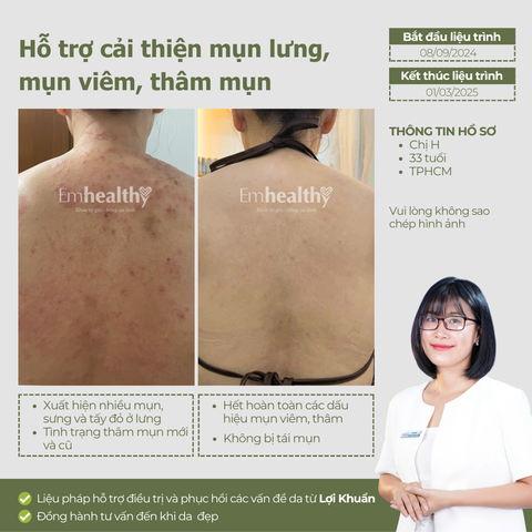 Combo 4 Hỗ Trợ Điều Trị Mụn, Nám & Phục Hồi Nền Da tại nhà | Có HLV đồng hành 3 tháng