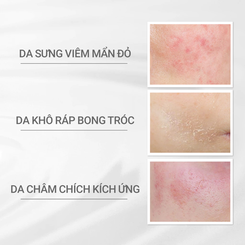 Kem dưỡng ẩm phục hồi SKIN REPAIR CREAM 45g | Dòng dưỡng vi sinh