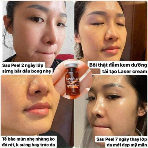 PEEL DA SINH HỌC NEOSTRATA RETINOL 3% – LỘT XÁC LÀN DA CHỈ SAU 7 NGÀY