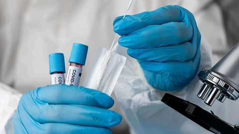 Những kinh nghiệm cần biết phòng ngừa Covid-19 quay trở lại 2025