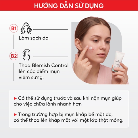 J11 Kem dưỡng giúp giảm mụn Blemish Control - Jean d'Arcel