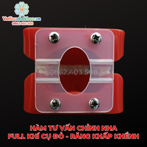 Hàm tư vấn chỉnh nha full khí cụ đỏ - Răng khấp khểnh