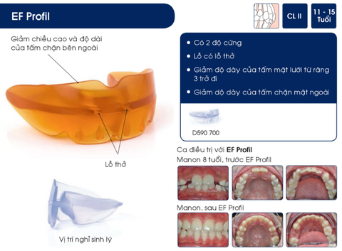 Hàm định hình khớp răng EF Line Orthoplus