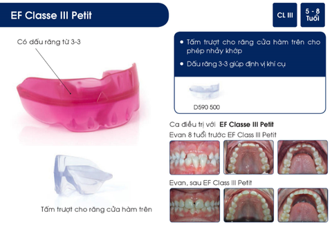 Hàm định hình khớp răng EF Line Orthoplus