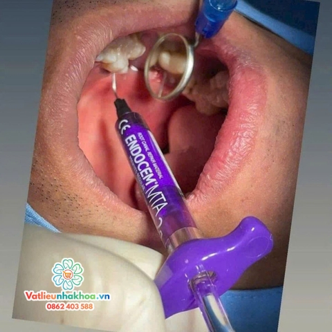 MTA trám bít ống tủy Endocem MTA - Maruchi