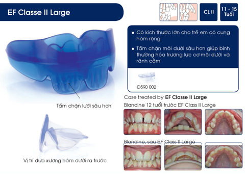 Hàm định hình khớp răng EF Line Orthoplus