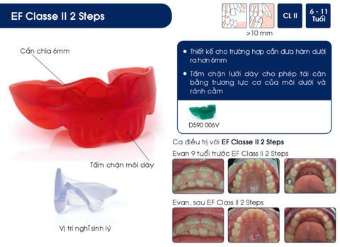 Hàm định hình khớp răng EF Line Orthoplus