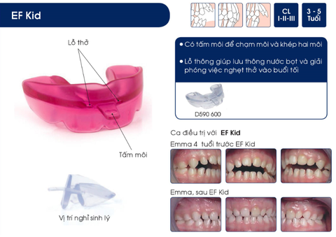 Hàm định hình khớp răng EF Line Orthoplus