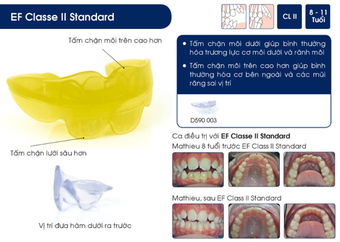 Hàm định hình khớp răng EF Line Orthoplus