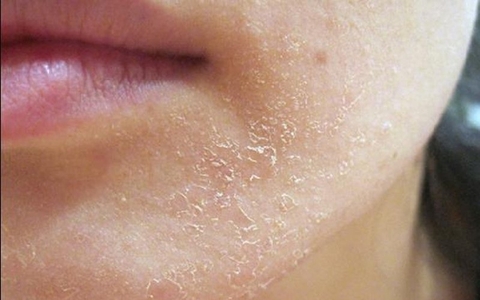 Routine Chăm Sóc Da Khô - Căng Mọng Suốt 24 Giờ