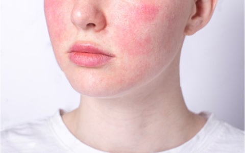 Routine phục hồi da sau treatment: 4 bước giúp da khỏe nhanh