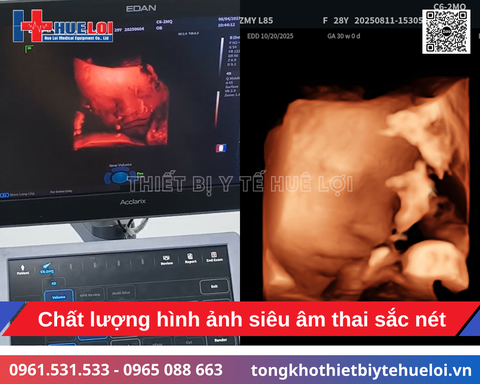 Hệ thống siêu âm bàn đẩy cao cấp Edan Acclarix LX85