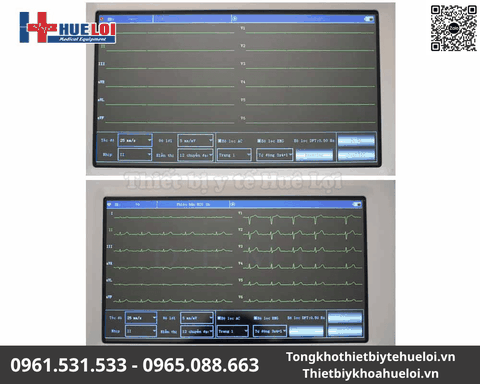 Máy điện tim 6 kênh Contec-600G | Màn hình cảm ứng