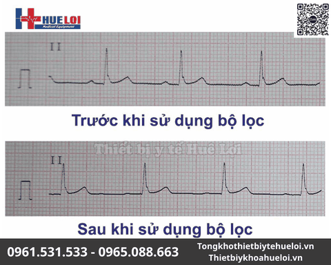 Máy điện tim 6 kênh Contec-600G | Màn hình cảm ứng