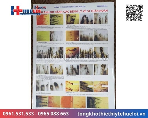 Kính hiển vi soi mạch máu DN-880 độ phóng đại 1200X | Huê Lợi