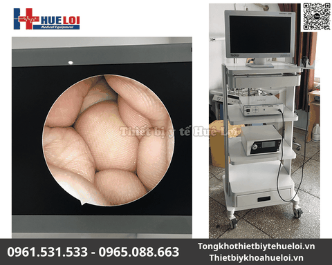 Máy Nội Soi Tai Mũi Họng SD TJ-168A | Huê Lợi