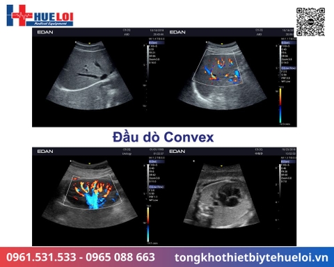 Máy siêu âm xách tay cao cấp EDAN AX3 (Acclarix AX3)