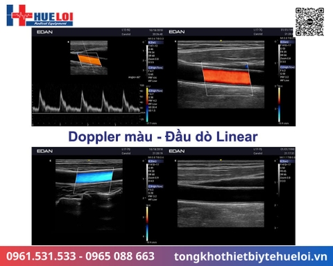 Máy siêu âm xách tay cao cấp EDAN AX3 (Acclarix AX3)