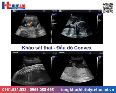 Máy siêu âm xách tay cao cấp EDAN AX3 (Acclarix AX3)