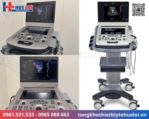 Máy siêu âm xách tay cao cấp EDAN AX3 (Acclarix AX3)