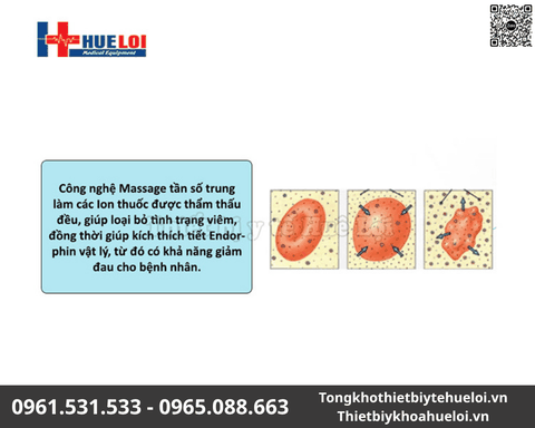 Máy trị liệu tuyến tiền liệt Sanwe - Giải pháp điều trị 3 trong 1 không xâm lấn