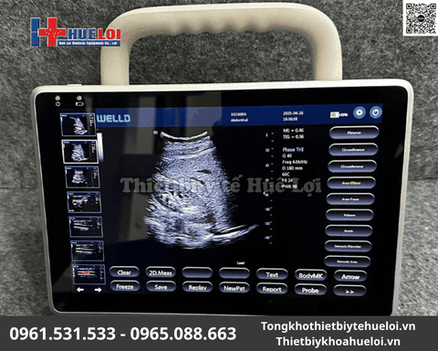 Máy Siêu Âm Xách Tay Cảm Ứng Well.D P10