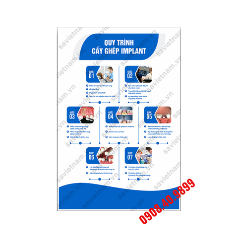 Tranh Implant nha khoa công nghệ cao - MS18