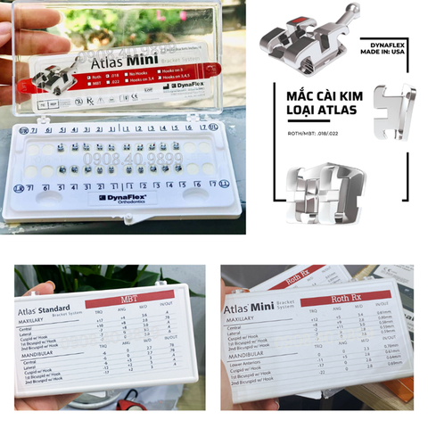 Bộ mắc cài kim loại Atlas Mini Dynaflex (MUA 2 TẶNG 1, 10 TẶNG 10)