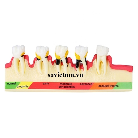 Hàm tư vấn bệnh lý nha chu