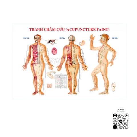 Tranh Châm cứu (Acupuncture paint)
