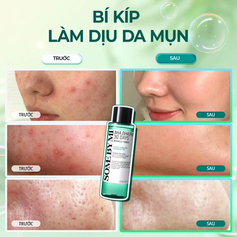 Nước hoa hồng Some By Mi AHA-BHA-PHA 30 Days Miracle Toner 150ml