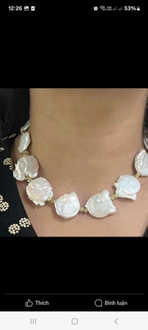 396-dây chuyền dị dẹt